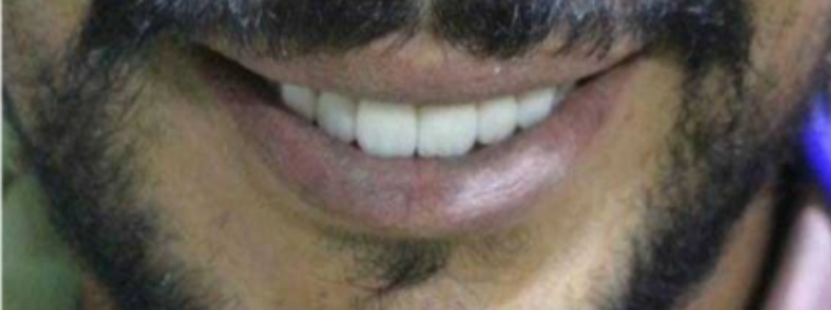 Before image